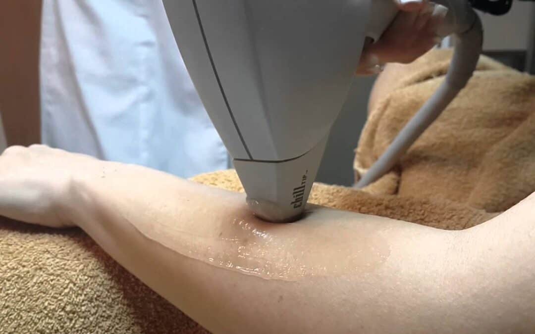 How Hair Removal Treatment Smithtown Can Transform Your Look